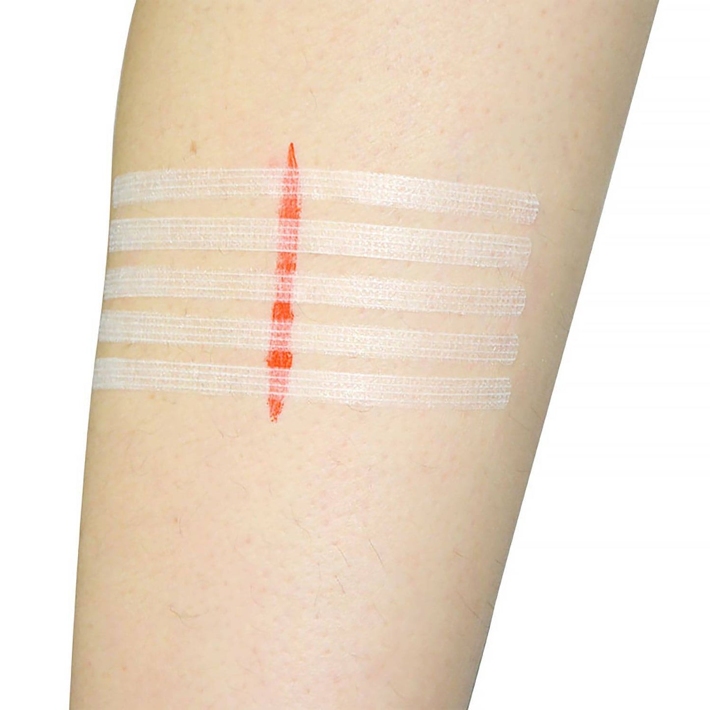 Teqler 6mm x 100mm Schmetterlingsnähte Packung 10