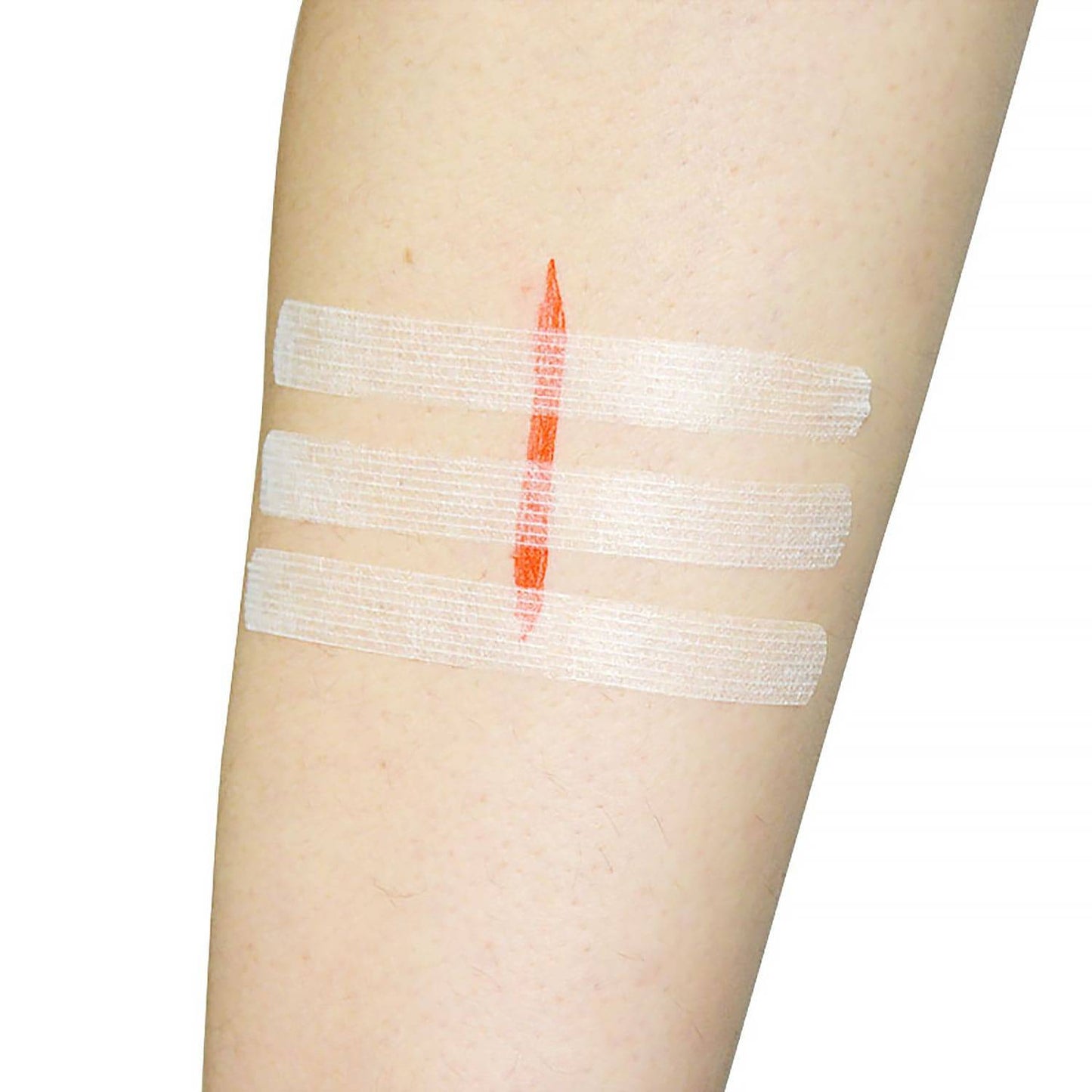 12mm x 100mm Teqler Schmetterlingsnähte (6er Pack)