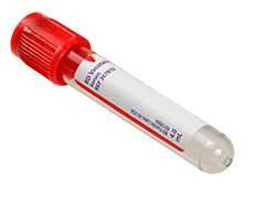 BD Vacutainer 2 ml Kunststoff-Serumtube Rot